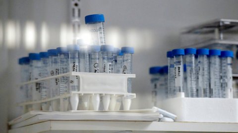 Cup, Test Tube.